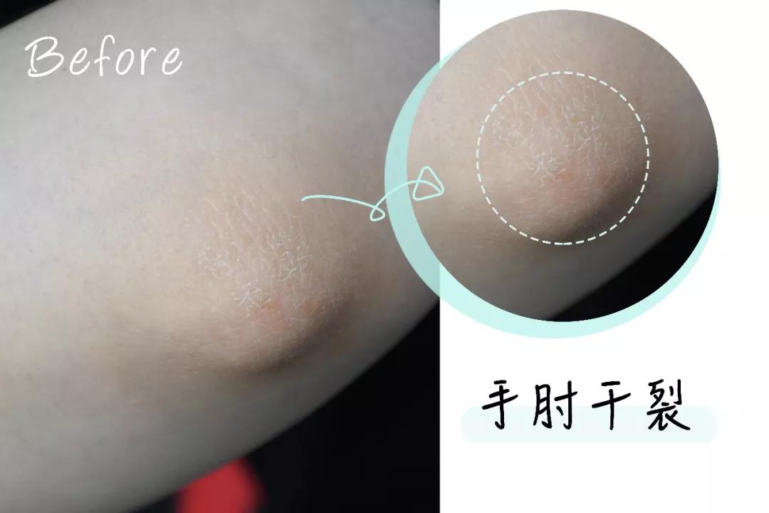 香椿苗的秘密是什么